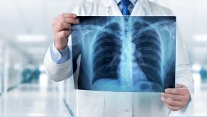 costo radiografia