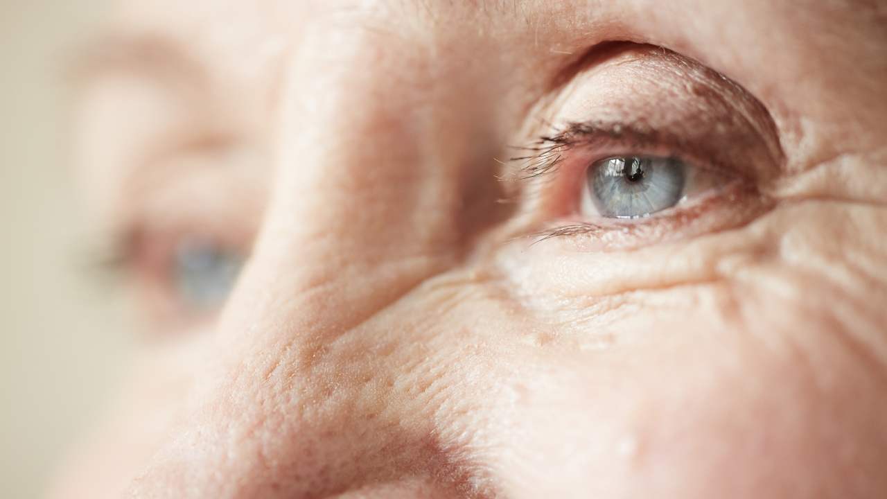 Alzheimer: potrebbe essere legato alla perdita della vista. - Solofinanza.it